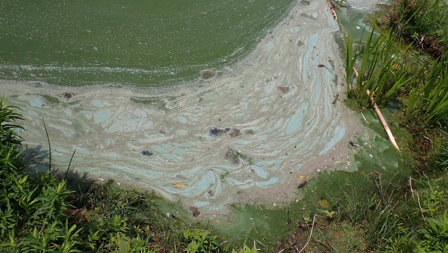 Blue-green Algae at Grenadier Pond, 2021. Photo: Karen Yukich